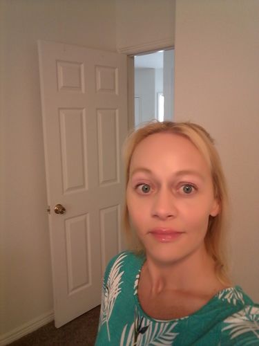 Customer photo review of EvenSkyn® Lumo: Premium Anti-Aging & Skin Tightening Handset