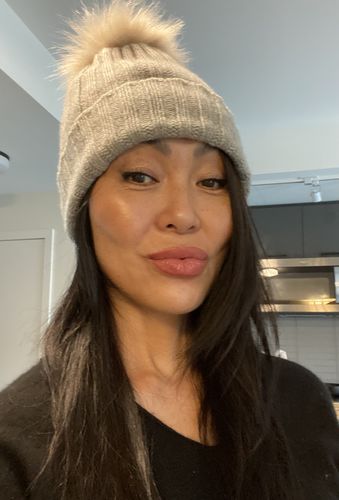 Customer photo review of EvenSkyn® Lumo: Premium Anti-Aging & Skin Tightening Handset