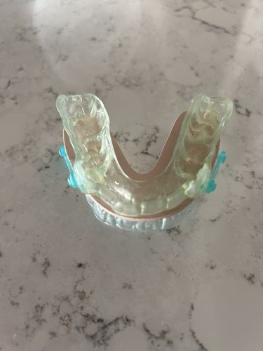Customer photo review of Elastic Mandibular Advancement Device