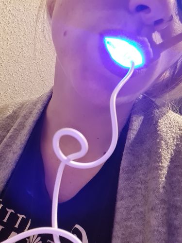 Customer photo review of Refill Whitening Gel