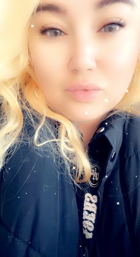 Customer photo review of Sequoia Green Contact Lenses(12 months of use)