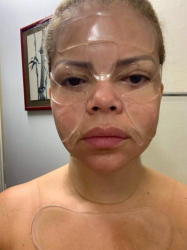 Customer photo review of Pylomo Anti-Falten-Pflaster