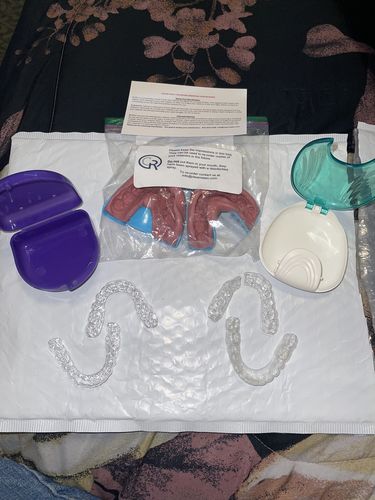 Customer photo review of Upper and Lower Retainers Set