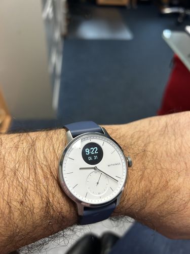 Kundenbewertung mit Foto zu Withings ScanWatch