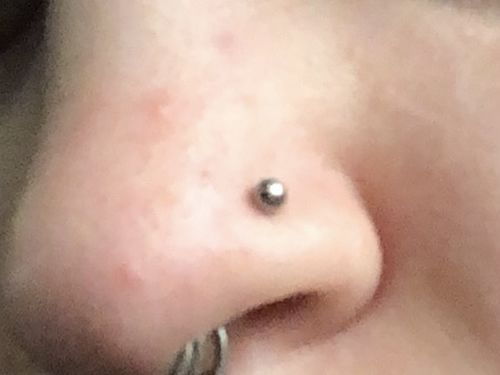 Customer photo review of Internally Threaded Ball 316L Steel Lip Ring