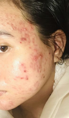 Customer photo review of Radiance Powder