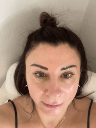 Customer photo review of Femvy Face and Body Skin Tightening Radio Frequency Device