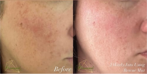 Customer photo review of Rescue Mist
