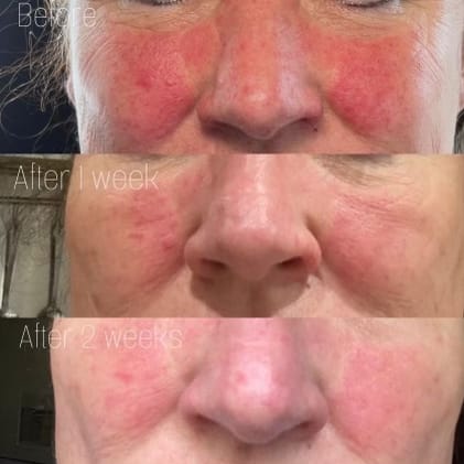 Customer photo review of Rescue Mist
