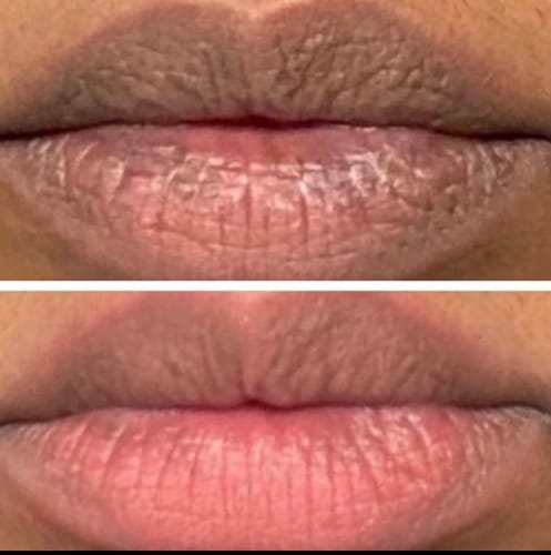 Customer photo review of Pink Lip Kit