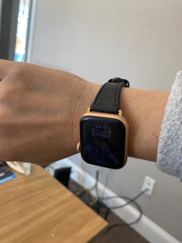 Customer photo review of Metallic Snakeskin Printed Band for the Apple Watch - FINAL SALE