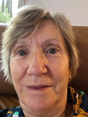 Customer photo review of SEA BUCKTHORN SERUM