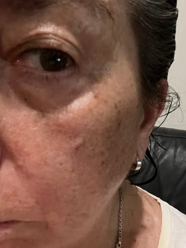 Customer photo review of SEA BUCKTHORN SERUM
