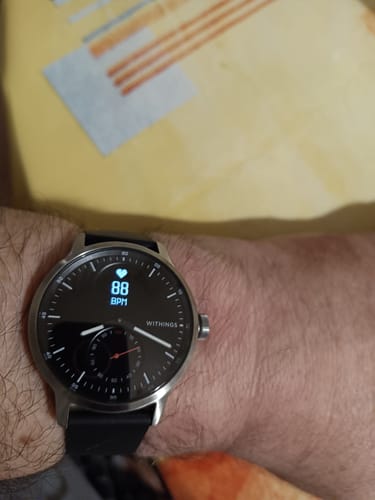 Kundenbewertung mit Foto zu Withings ScanWatch