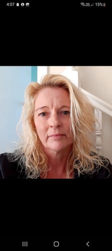 Customer photo review of SEA BUCKTHORN SERUM