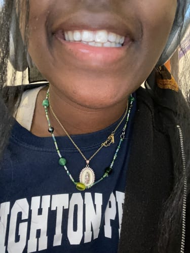 Customer photo review of Upper Teeth Retainer