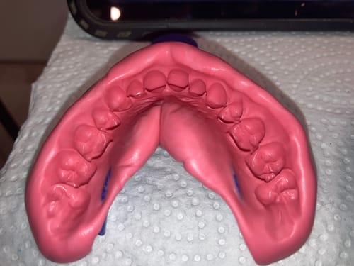 Customer photo review of Extra Impression Putty (STRONGLY RECOMMENDED)