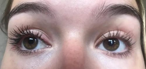 Customer photo review of GFOUK™ LashElixir Rapid Growth Strengthening Eyelash Serum