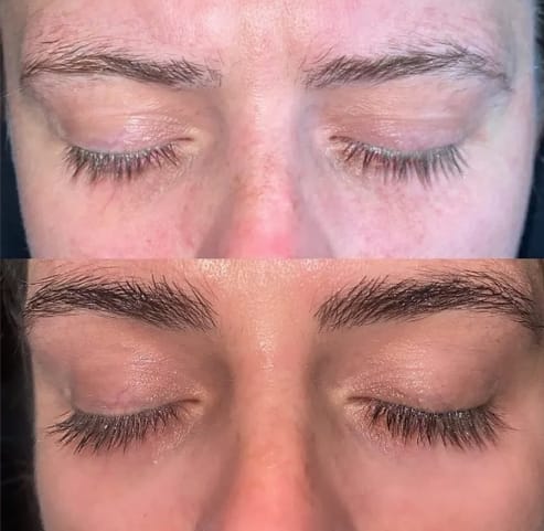 Customer photo review of GFOUK™ LashElixir Rapid Growth Strengthening Eyelash Serum
