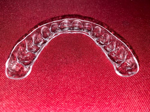 Customer photo review of Upper Teeth Retainer