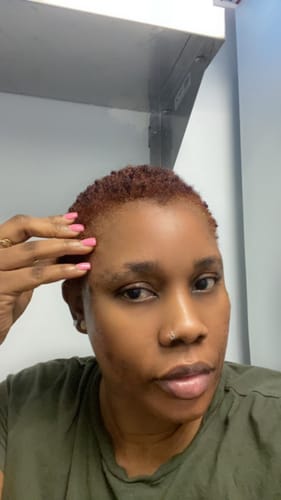 Customer photo review of Advanced Brightening Green Tea Toner 60 ML