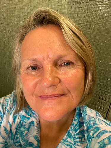 Customer photo review of SEA BUCKTHORN SERUM
