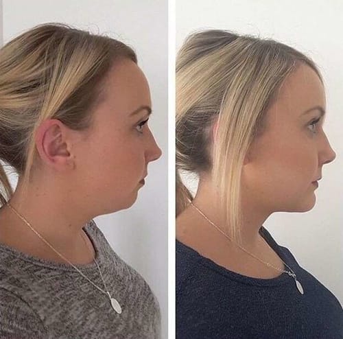 Customer photo review of Lymph Flow Magnetogen Earrings(🔥LAST DAY SALE-80% OFF)