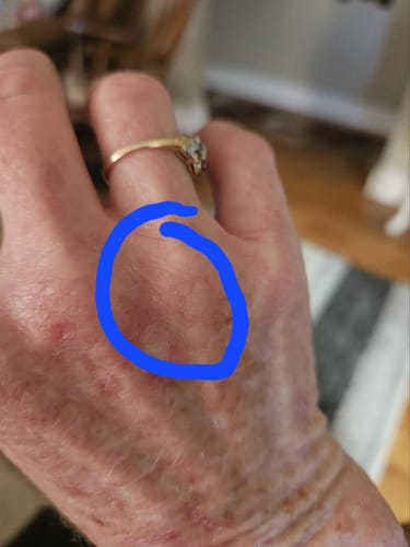 Customer photo review of KrX Custo:Med Set