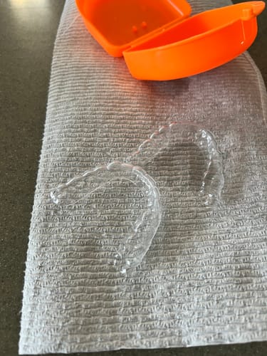 Customer photo review of Extra Impression Putty (STRONGLY RECOMMENDED)
