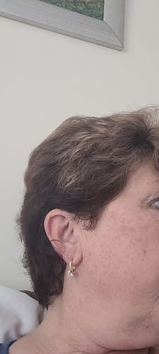 Customer photo review of (🔥LAST DAY SALE-80% OFF) Lovefinity™ Lymphvity MagneTherapy Germanium Earrings