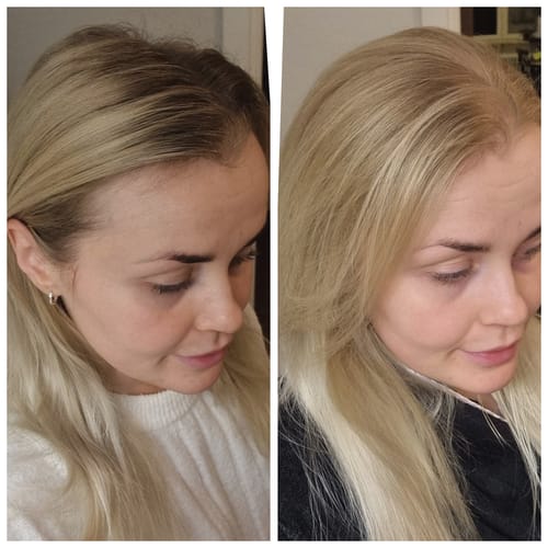 Customer photo review of Sunkissed Starter Kit