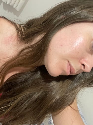 Customer photo review of Solução Niacinamida