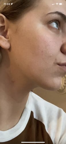 Customer photo review of Corthe Dermo Pure First Aid Lotion