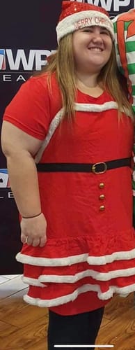 Customer photo review of Lipo Bites ACV Gummies 1000MG