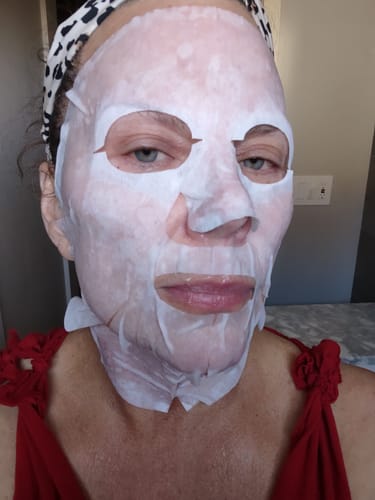 Customer photo review of KrX CO2 Carboxy Therapy