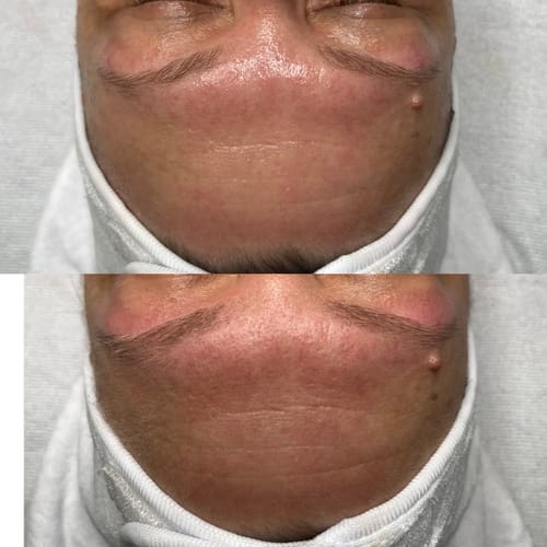 Customer photo review of KrX Youthplex Face Lift Cream