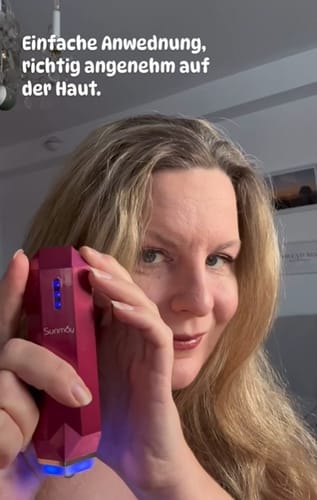 Customer photo review of SUNMAY VSkin Radio Frequency & EMS Technology 2 in 1 Face Lift Device
