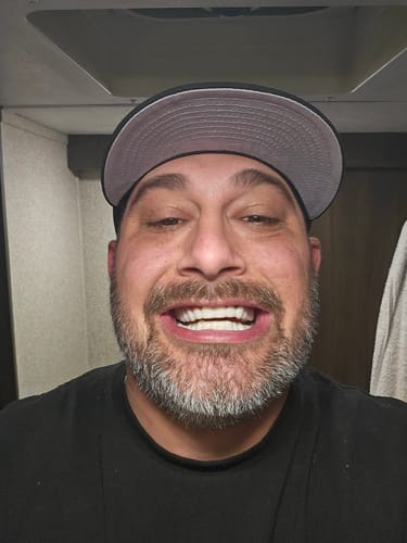 Customer photo review of Pop On Veneers with Impression Kit