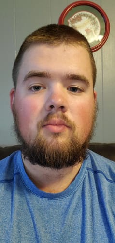 Customer photo review of Ultimate Beard Bundle