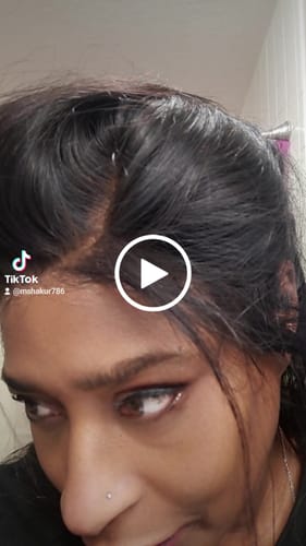 Customer video review of The complete all in one wig install kit