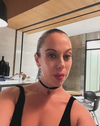 Customer photo review of WrinkleFix: Botox (Existing Customers)