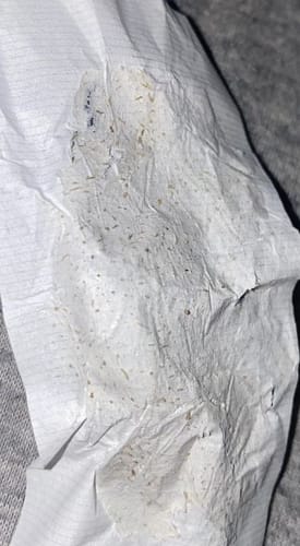 Customer photo review of Luelle Pore Strips