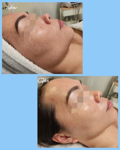 Customer photo review of KrX OxyGlow Spirulina Bubble Cleanser