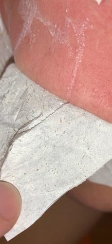 Customer photo review of Luelle Pore Strips