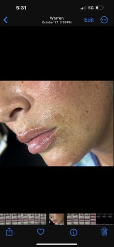 Customer photo review of Scalpa HyaInfuse