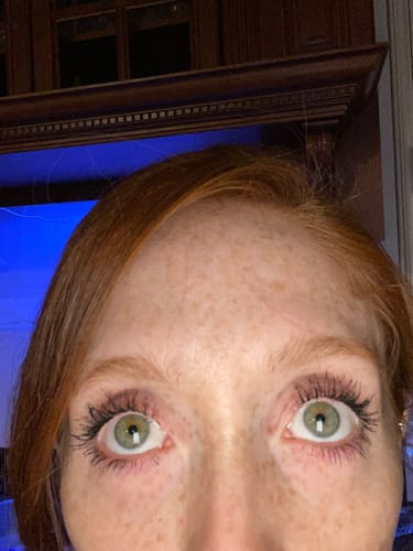 Customer photo review of ETERNAL EYELASH GROWTH SOLUTION