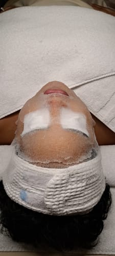 Customer photo review of KrX Cryofacial Caps