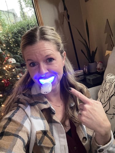 Customer photo review of ETERNAL TEETH WHITENING KIT