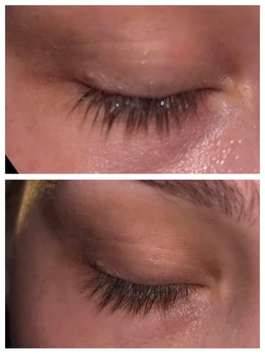 Customer photo review of LASH GROWTH SERUM