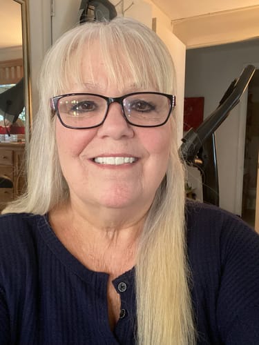 Customer photo review of Pop On Veneers with Impression Kit